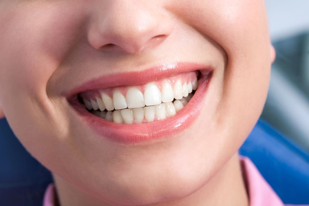 Teeth Whitening Clinic Nearby in Fort Wayne | Convenient & Trusted Care