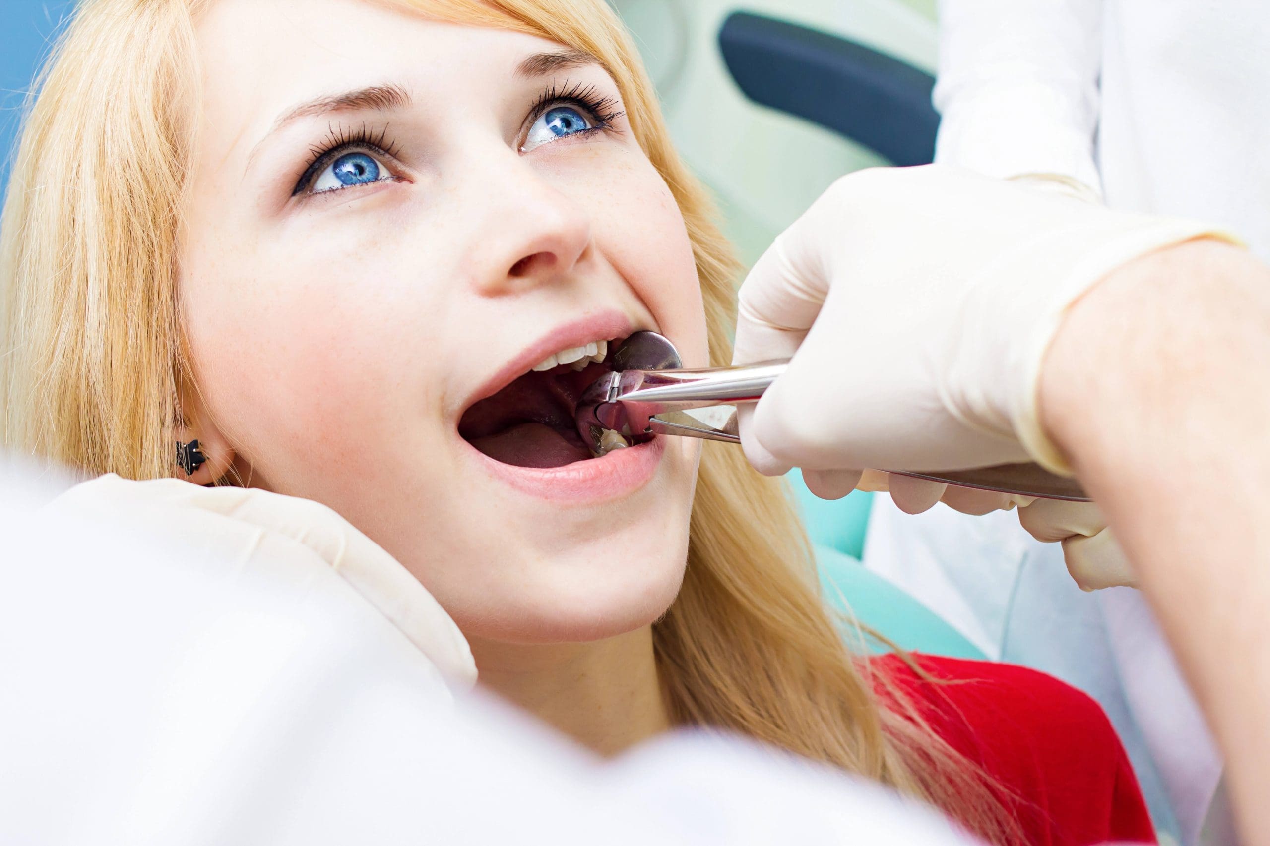 Emergency Tooth Extraction: What to Expect When You Need Immediate Help